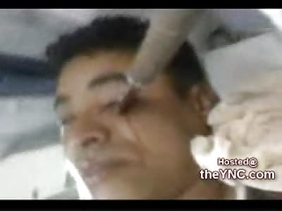 Lucky Man stabbed in the Face