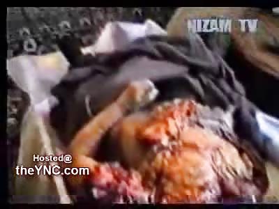 Family Grieves over their Ripped in Half Son