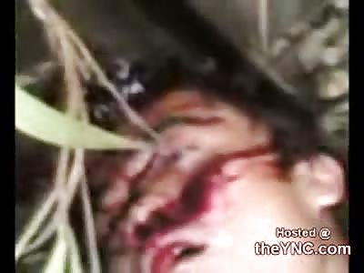 Guy Shot in the Forehead and Left for Dead on the Side of the Road 