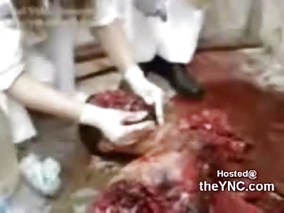 Trying to Identify a Suicide Bomber