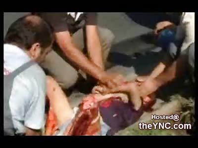 Young Kid writhes in Pain with his Legs Skinned to the Bone