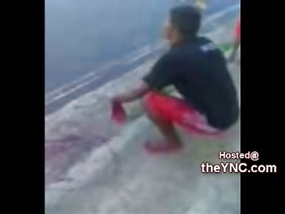 Mans Hand Dangling by Tendons begs for Help on the Street