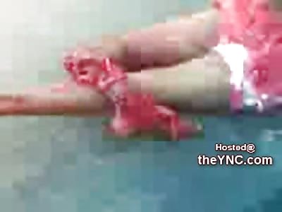 Leg Thoroughly Mangled, Squirming in Pain