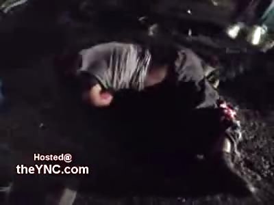 Battered and Mangled Body of a Drunk Driver