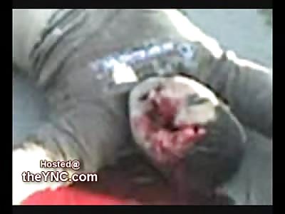 Boy loses his Face Racing his Bike