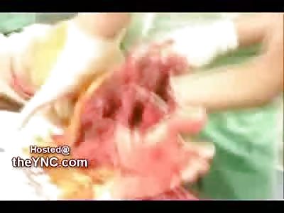 Keep your Feet AWAY from the Train Tracks