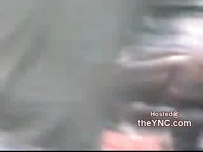 Ladies Leg FUBAR'd after Accident