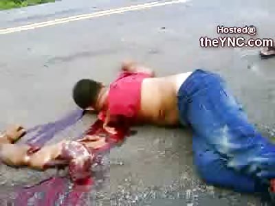 GRAPHIC: Man has Arm Torn off of Shoulder Blade....