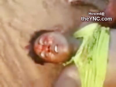 Bloody Accident leaves Female with Leg Ripped Off.....2 Teens Bloody on the Street