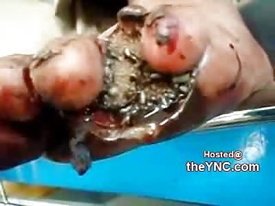 Drug Addict has a Big Problem on his Foot