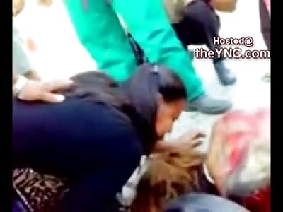 Comforting a Female Cooked Alive Moments after Horrible Motorcycle Accident