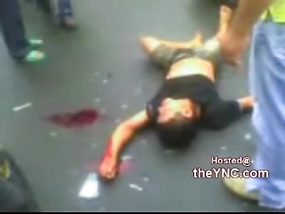 Bicycle Rider Lay Dying in the Road after being Nailed by Car