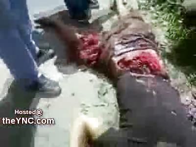 IF you hit a Guardrail at 100 MPH...you might Look Like This