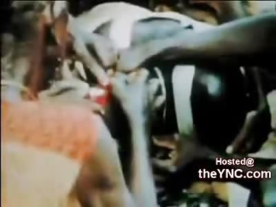 Disgusting Open Skin Surgery Performed in Africa