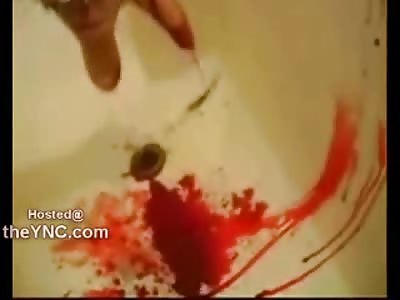 Suicidal Teen Blood Spurting Self Destruction