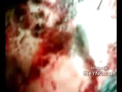 Shot in the Head Still Awake and Still Smiling