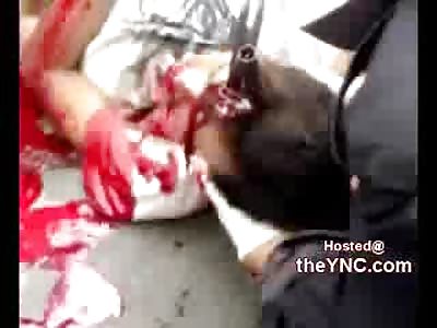 Motorbike goes into Mans Brain,,,,Fatal Injury