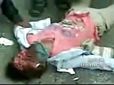 Graphic and Extraordinary: Female Scooter Rider wearing Glasses loses her Face in Horrible Accident