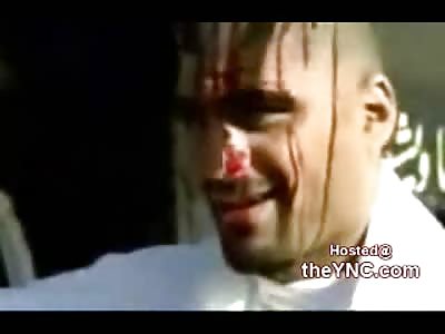 Radical Arab Shi'its Hold Blood Ceremonies Cutting their Heads With Razors to Honor Terrorists