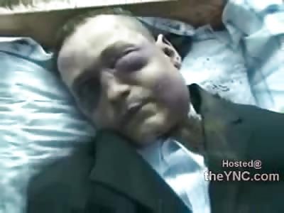 A Very Bizarre Look into a Dysfunctional Russian Mental Ward