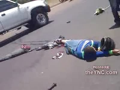 Long Leg Ripped from Kid lying in the Road