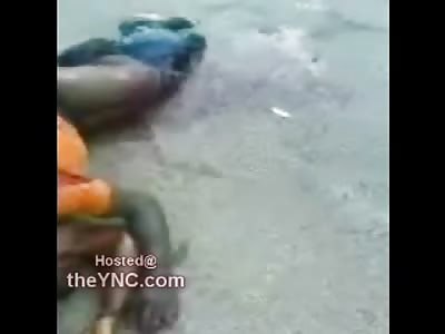 OMG: Wait till you See What Happened to this Mans ASS (Very Gross)