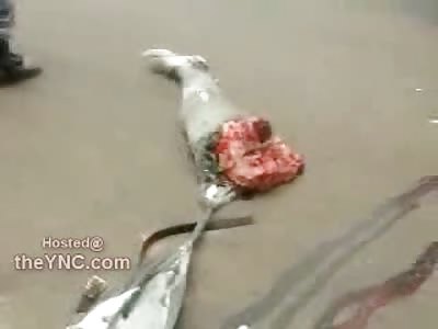 WOW: Remember the Guy with the Leg Ripped Off from Last Week? Well He was Alive and This VIdeo Shows it Up Close