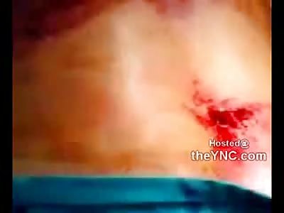 Mad Lies Dying after Being Stabed All over His Body