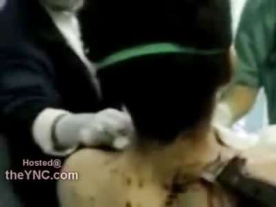 INCREDIBLE: Boy has Hunting Knife DIRECTLY through the Neck