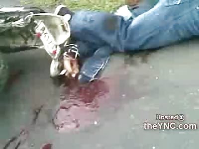 Groaning and Squirming, Cracked Bones and Compound Fractures