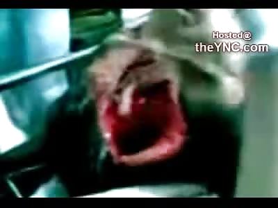 To the Bone..Woman's Head SPLIT Open from a Machete to the Skull