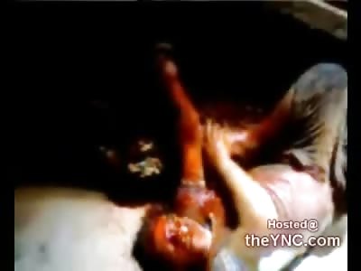 Killer takes his Final Breaths while Man Films