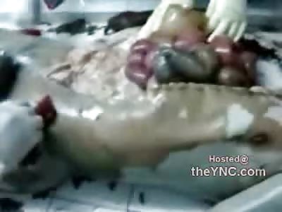 LOL: Medical Students Having a Little TOO much Fun with this Corpse....