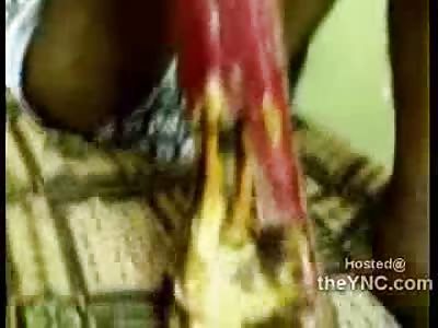 Iraqi Man Electrically tortured by Iraqi Police