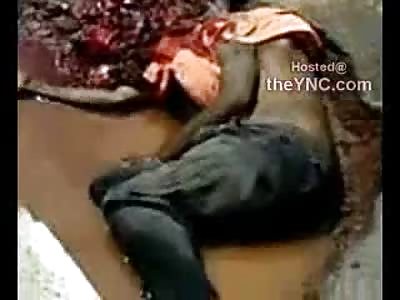 Homeless Man Head Run Over by Truck has Brans out like a.....I Dont Really Know