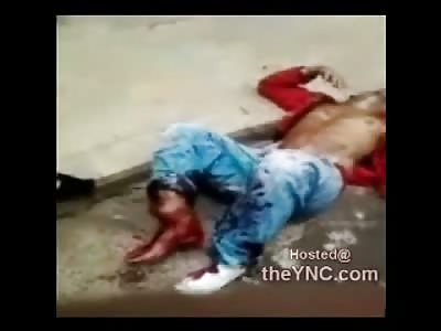 Man with Dangling Foot Screaming in Pain in the Street