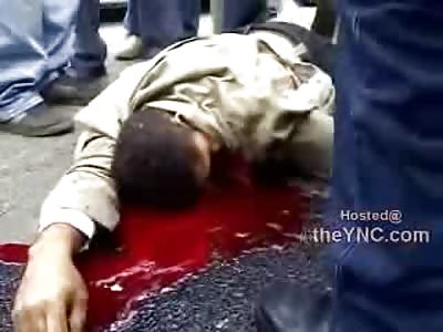 Boy's Face Ripped Off lies in Pool of Blood