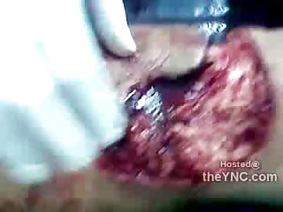 Woman Moans in Pain as EMT moves her Smashed Knee Cap with his Hands