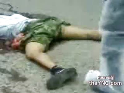 And he Looks Even WORSE when they Turn Him Over