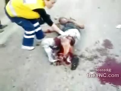 Man with Face Ripped off and his Friend has a MAJOR Leg Problem