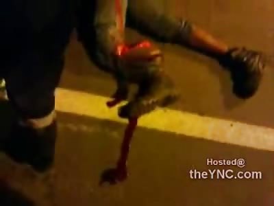 Foot Just Dangling after Accident 