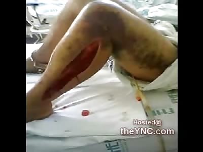 Rapist Lynched in Prison still has his Shackles On