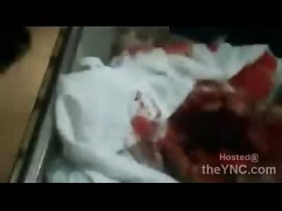 Bahrain:  Second Protestor Killed has GIANT Hole in his Head