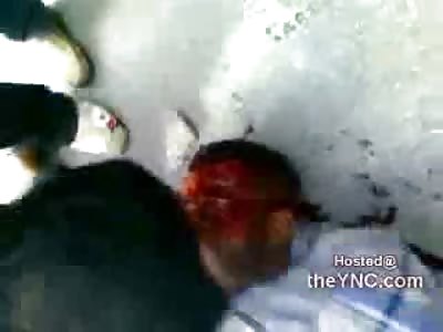 Shot in the Head ....Blood Pours Like a Siv 