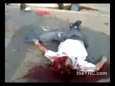 Everyone Ejected lies Dishevelled in the Road