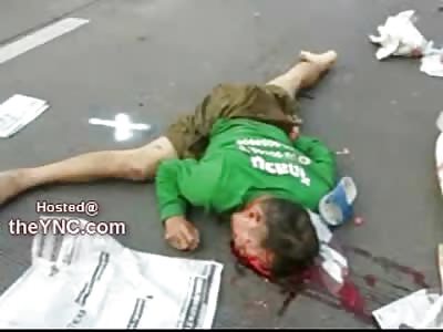 YNC Exclusive: Man has Entire Brain Sitting on the Street after being Run Over by Speeding Car