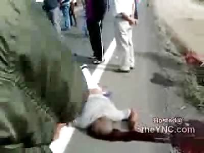 Head Open on the Concrete after Motorcycle Accident