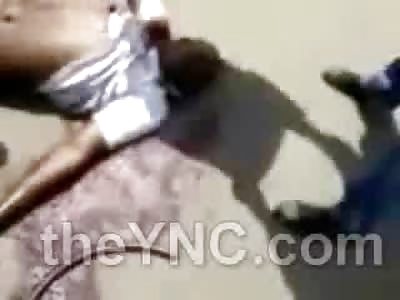 2 Men Ripped from Limbs on the Street in the Ivory Coast