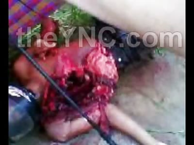 The Helmet Worked at Least?  Still Alive