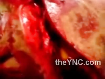 Mans Killed with Machete has Entire Face Opened up